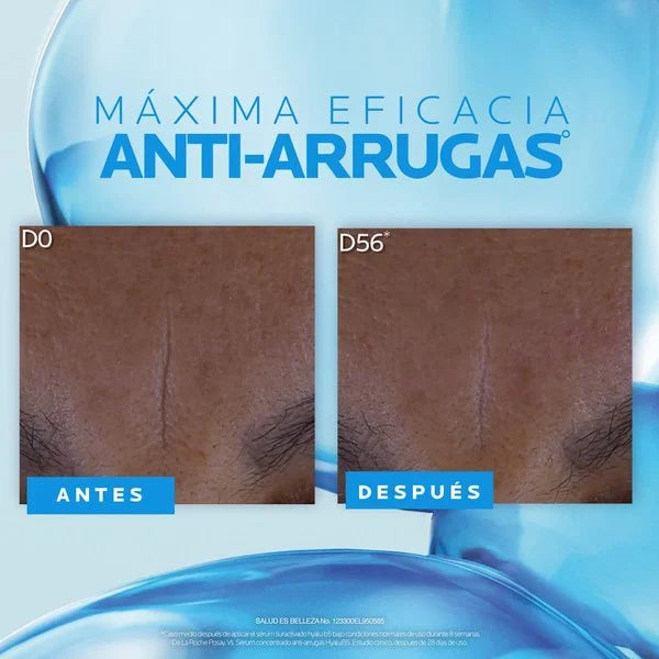 La Roche-Posay Hyalu B5 Suractivated Serum Antiarrugas y Reparador 30 ml