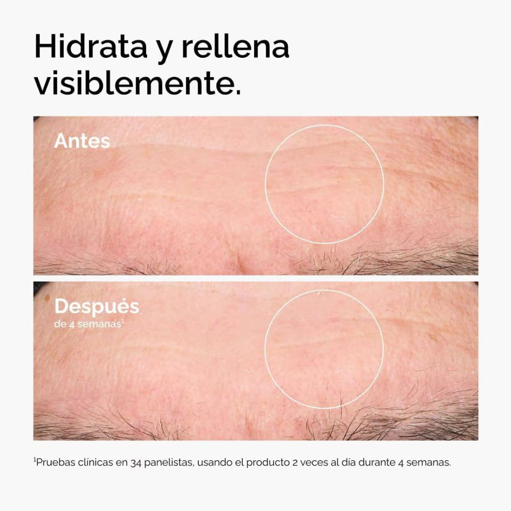 The Ordinary Hyaluronic Acid 2% + B5