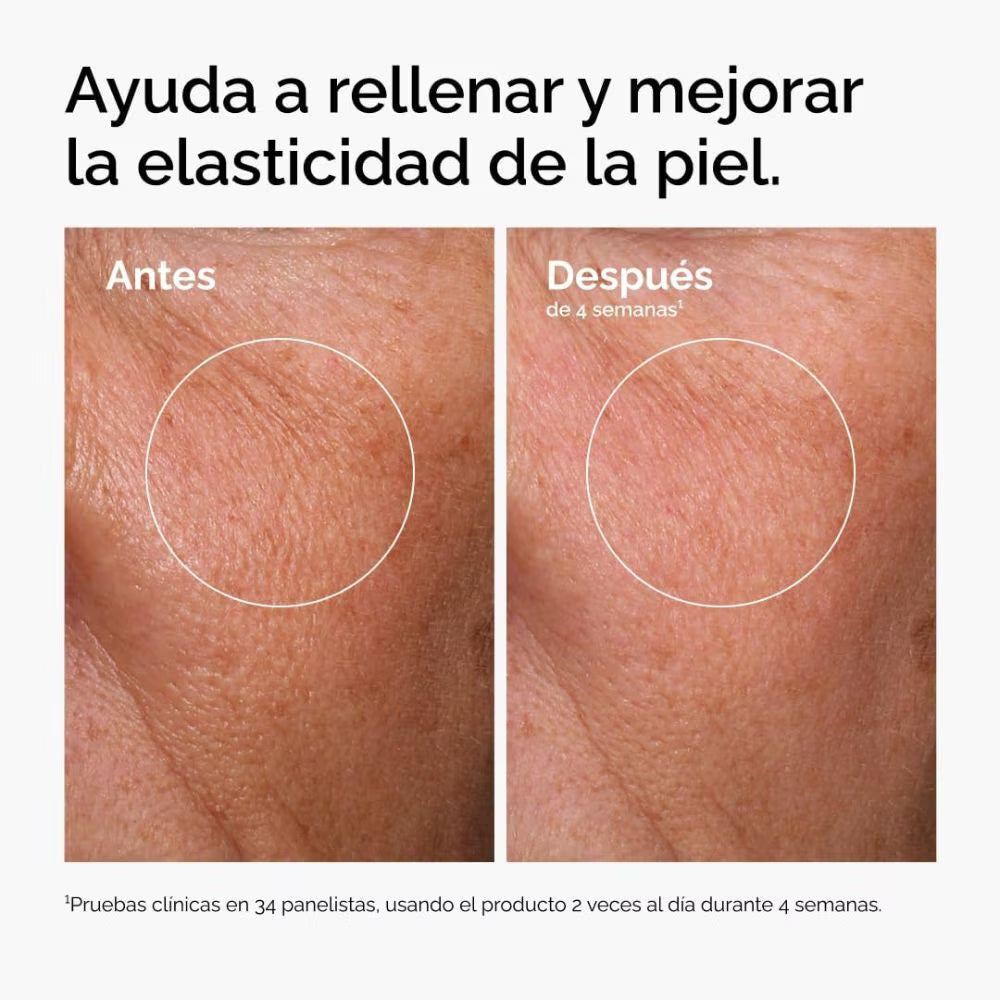 The Ordinary Hyaluronic Acid 2% + B5