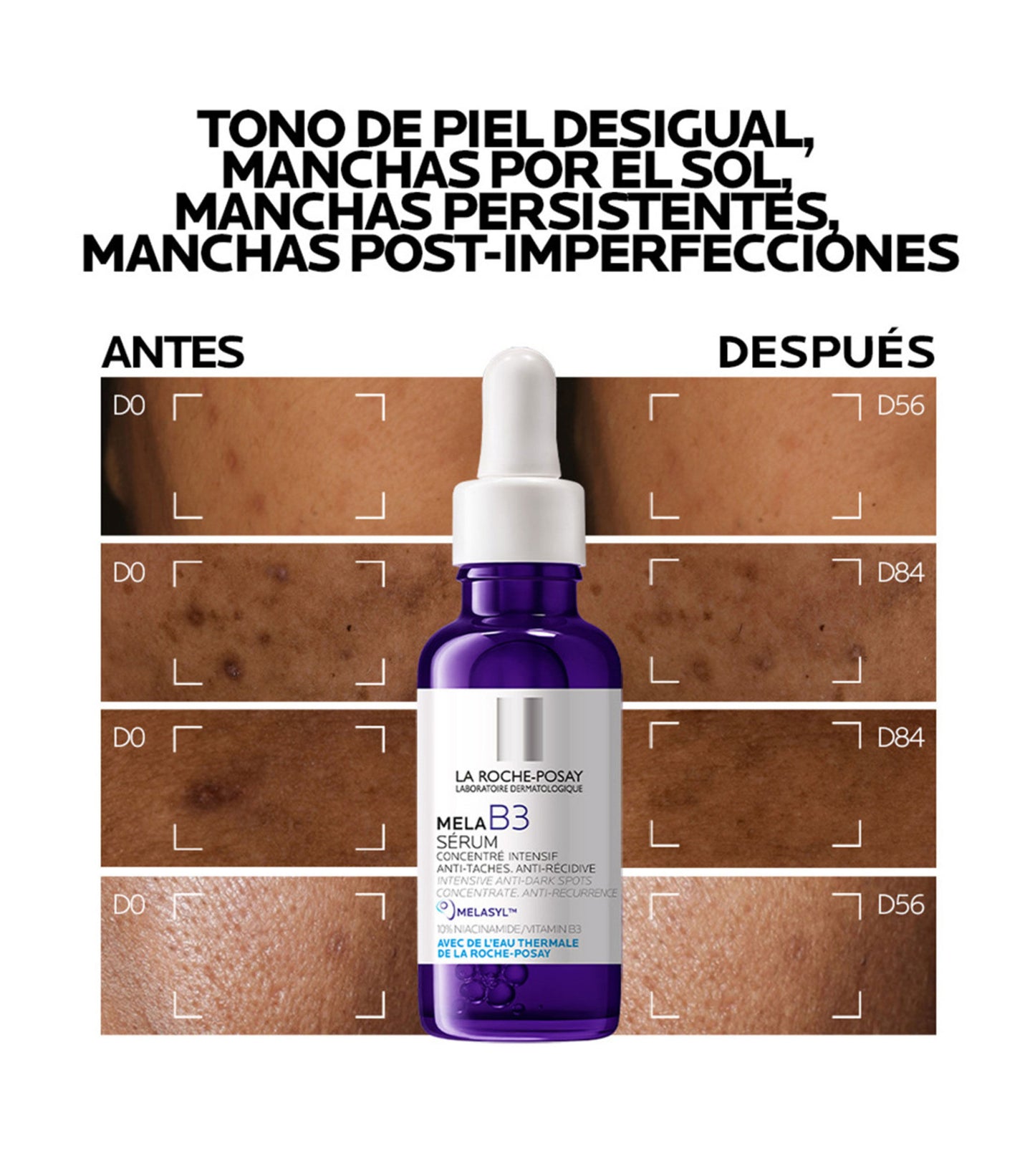 La Roche-Posay Sérum Mela B3 Anti-manchas y antienvejecimiento para piel sensible 30 ml